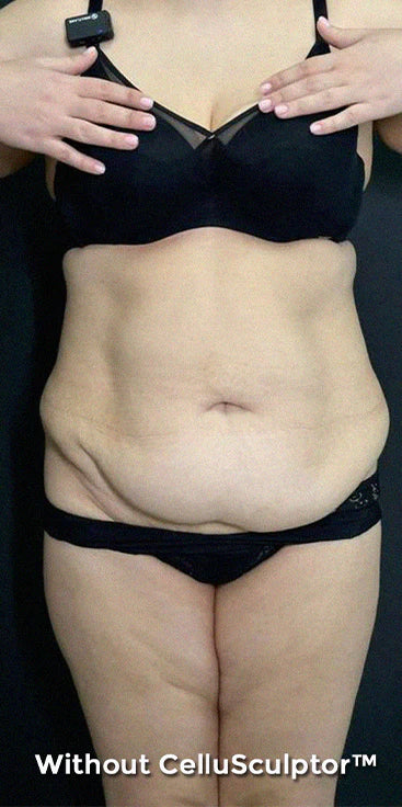 Before - Emily 