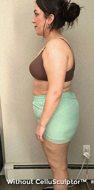 Before - Laura