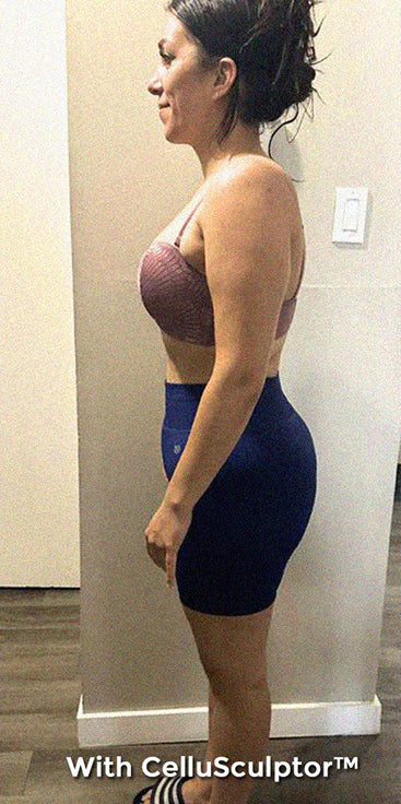 After - Laura