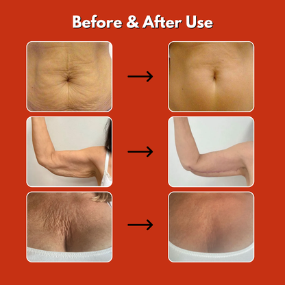 Anti-Cellulite Magic Oil 100ml